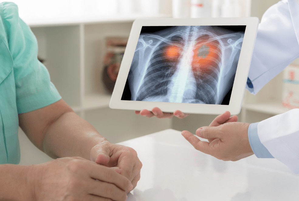 A person holding an ipad with an x-ray on it.